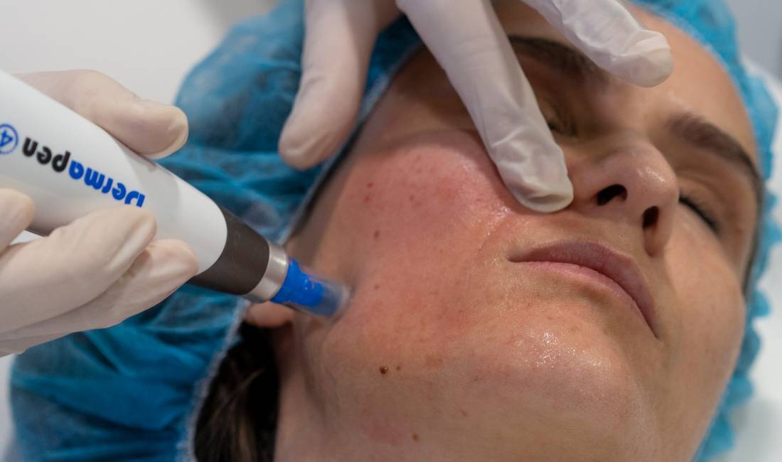 Klinike dermo-estetike ofron sherbime duke perdorur teknologjine me te fundit