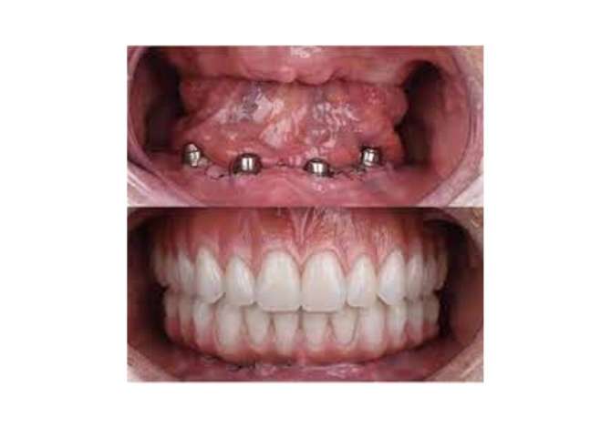 Klinike Dentare ofron game te gjere sherbimesh me cilesi dhe profesionalizem te larte