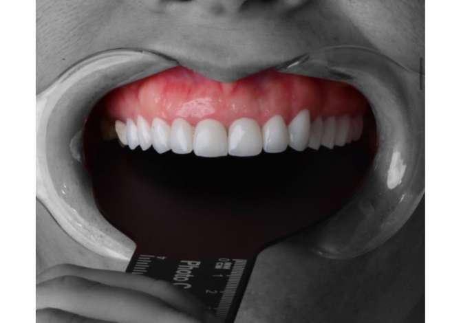 Klinike dentare qe ofron sherbim ne parandologji ,estetike dentare,implantologji,ortodenci