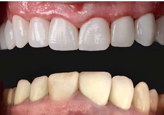 Sherbime Shendetesore dhe Estetike ne Tirane - 0 