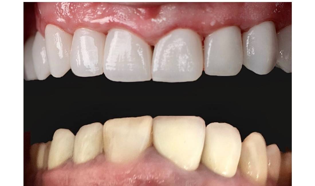 Klinike dentare qe ofron sherbim ne parandologji ,estetike dentare,implantologji,ortodenci