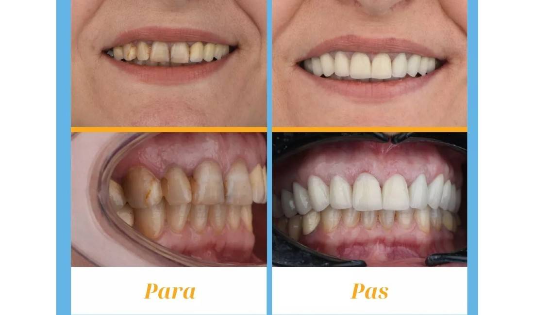 Klinike dentare dhe laborator ofron sherbime si stomatologji,trajtim endodontik,ortodenti,estetike,pedodonti