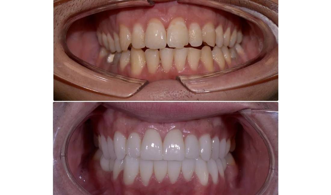 Klinike dentare ofron sherbime me profesionalitet te larte ne fushen e estetikes dentare,faciale,kirurgji orale-maksilo-faciale,implantologjise.