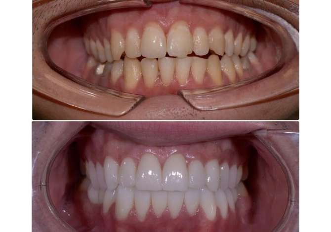 Sherbime Shendetesore dhe Estetike ne Tirane - 0 