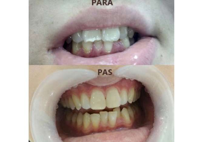 Sherbime Shendetesore dhe Estetike ne Tirane - 0 