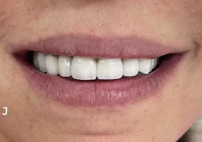 Sherbime Shendetesore dhe Estetike ne Tirane - 0 