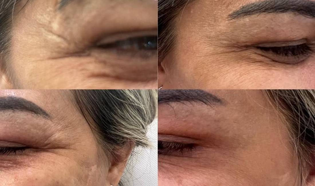 Klinike estetike ofron trajtime te flokeve,trupit dhe fytyres