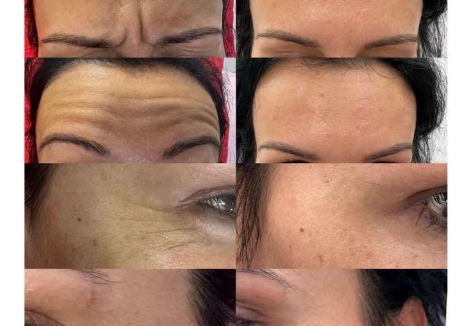 Klinike estetike ofron trajtime te flokeve,trupit dhe fytyres