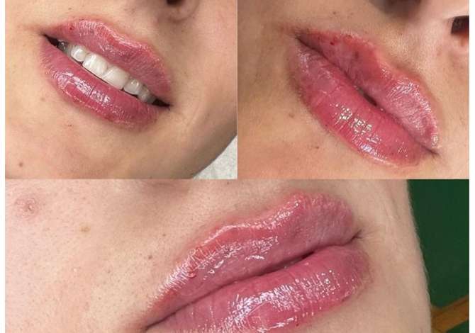 Sherbime Shendetesore dhe Estetike ne Tirane - 30 Euro