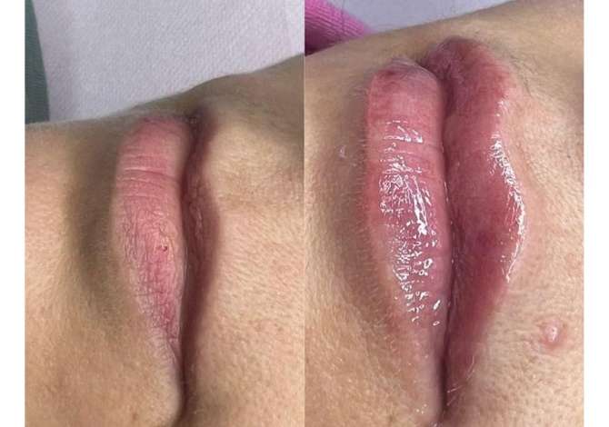 Sherbime Shendetesore dhe Estetike ne Tirane - 30 Euro