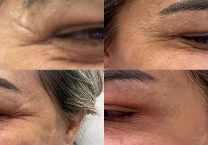 Servizi di salute e belleza a Tirana - 30 Euro