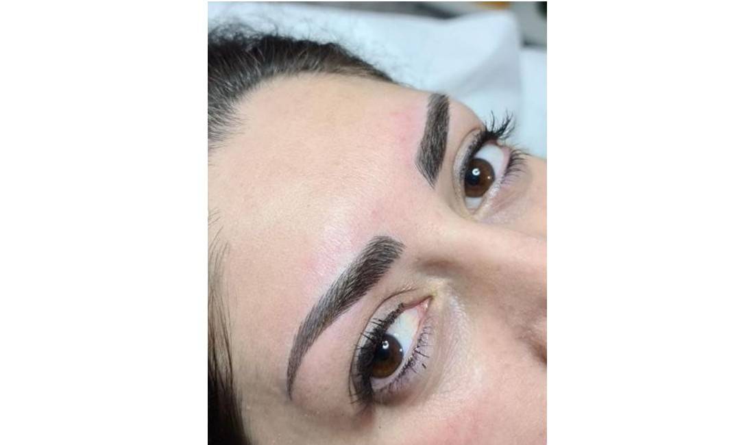 Klinike estetike ofron trajtime dermoestetike,dermapen,filler,botox,fibroblast,anticelulit,microblanding