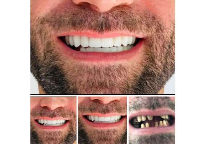 Sherbime Shendetesore dhe Estetike ne Tirane - 0 