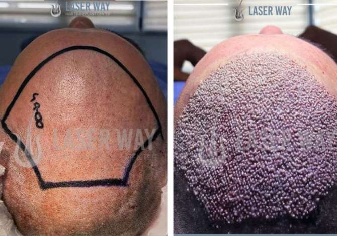 Health and Beauty Services in Tirana - 40 Leke