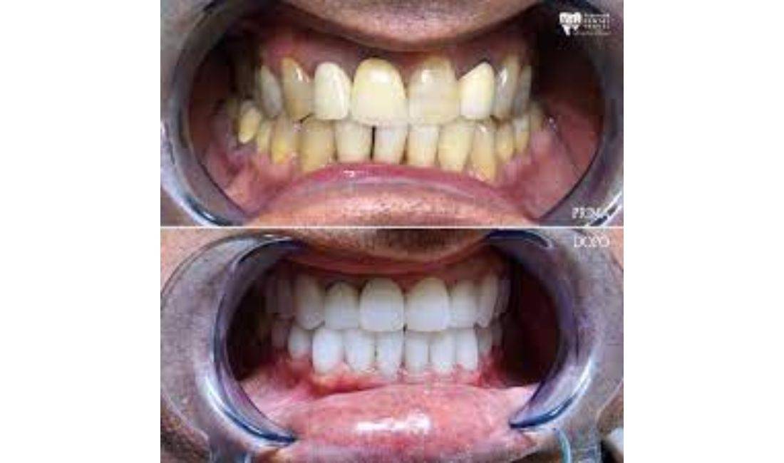 Klinik dentare ofron sherbime per ortopedi, ortodonci, terapi, laborator, estetik dhe kirurgji implantologji 