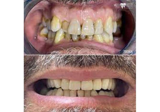 Klinik dentare ofron sherbime per ortopedi, ortodonci, terapi, laborator, estetik dhe kirurgji implantologji 