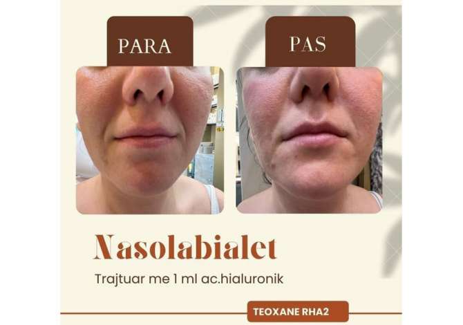 Health and Beauty Services in Tirana - 0 