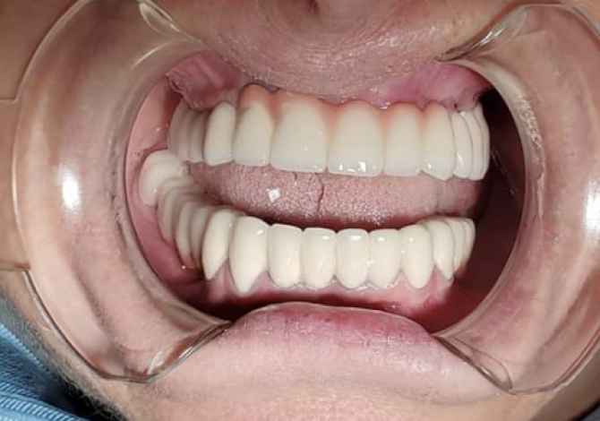 Sherbime Shendetesore dhe Estetike ne Tirane - 100 