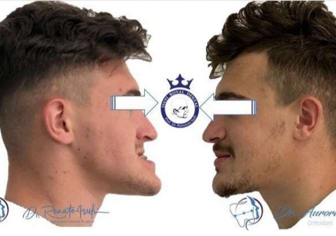 Klinike dentare me nje staf te specializuar ne Kirurgji Orale dhe Maksilofaciale, Implantologji,